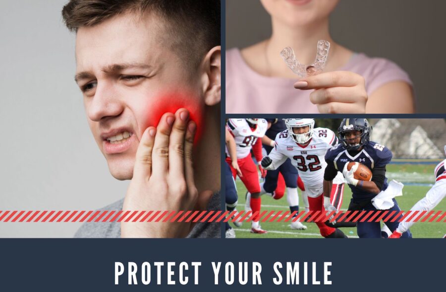 The Many Benefits of Mouth Guards: Smile Design Manhattan